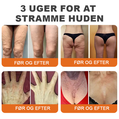 👨‍⚕️💎✨Fremstillet og afsendt fra Danmar✨Flysmus ™ Botox Bivenom Fastgørende Serum Stick👩‍🔬SIDSTE DAG 70 % RABAT