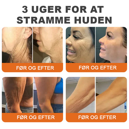 👨‍⚕️💎✨Fremstillet og afsendt fra Danmar✨Flysmus ™ Botox Bivenom Fastgørende Serum Stick👩‍🔬SIDSTE DAG 70 % RABAT