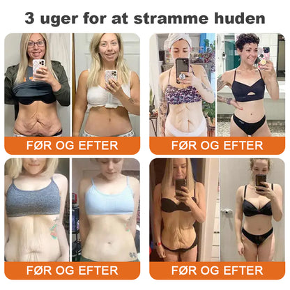 👨‍⚕️💎✨Fremstillet og afsendt fra Danmar✨Flysmus ™ Botox Bivenom Fastgørende Serum Stick👩‍🔬SIDSTE DAG 70 % RABAT