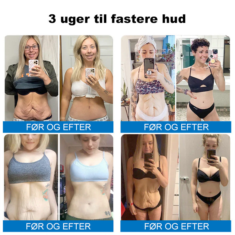❤️‍🔥💐Furzero® Hudopstrammende Creme med Oligopeptider