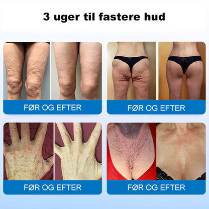 ❤️‍🔥💐Furzero® Hudopstrammende Creme med Oligopeptider