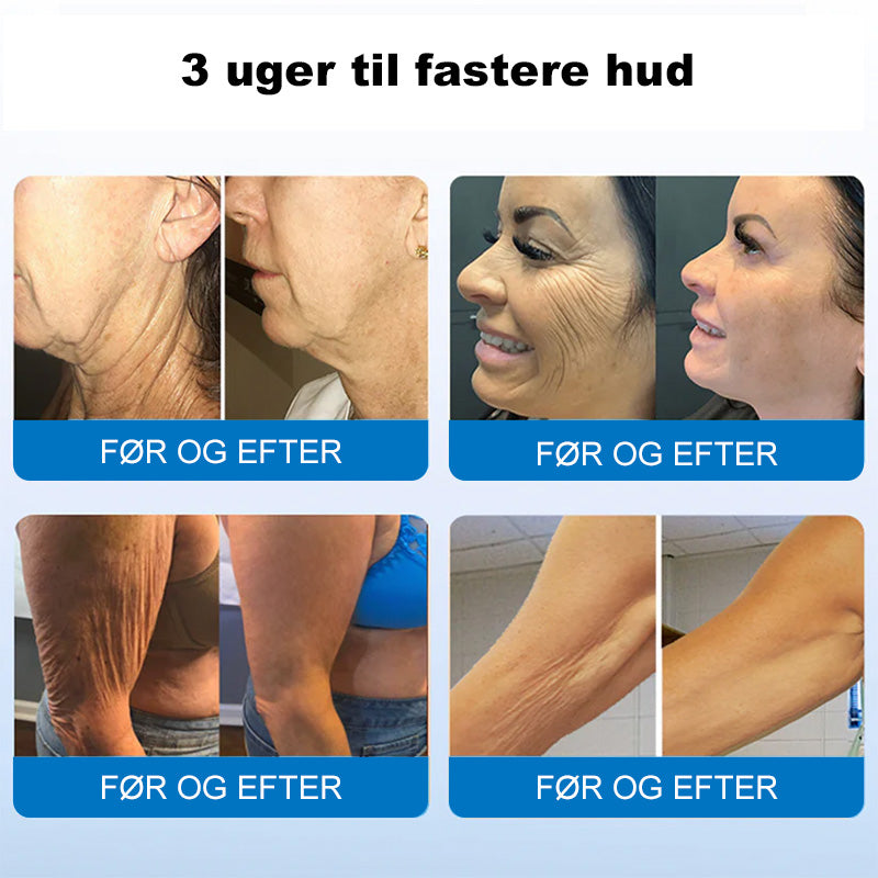 ❤️‍🔥💐Furzero® Hudopstrammende Creme med Oligopeptider