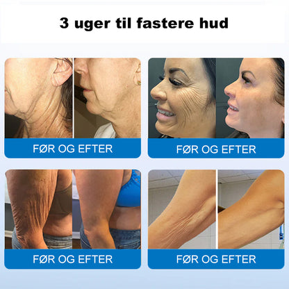 ❤️‍🔥💐Furzero® Hudopstrammende Creme med Oligopeptider