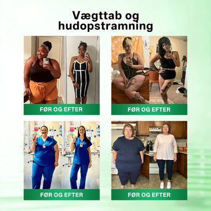 Officiel Butik |💝 Evolvion® Moringa · Berberin × NAD⁺ 10-i-1 Avanceret Nano Microneedle-plaster(Kun én gang dagligt – synlige forandringer på 7 dage)✅ Til fedme, løs hud, diabetes, søvnapnø, ledproblemer og meget mere