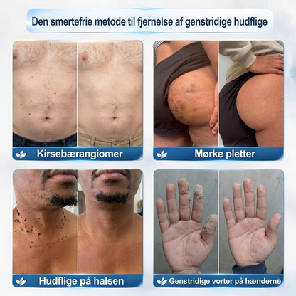 Få 30 % rabat på det andet eksemplar af samme produkt💯💯