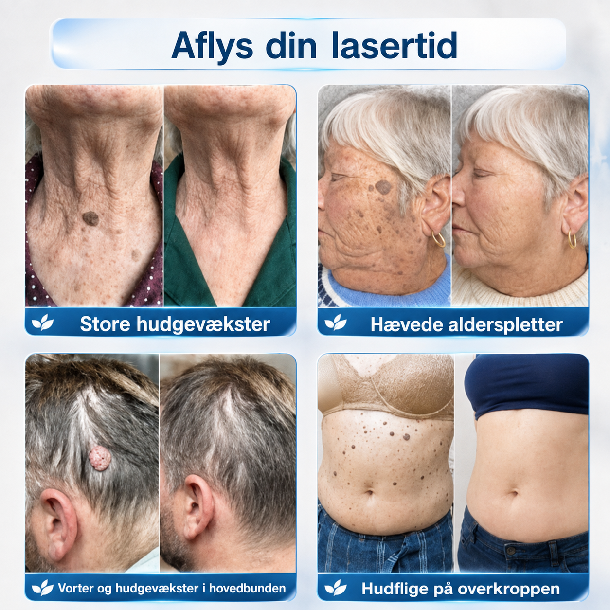 Få 30 % rabat på det andet eksemplar af samme produkt💯💯