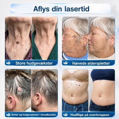 Få 30 % rabat på det andet eksemplar af samme produkt💯💯